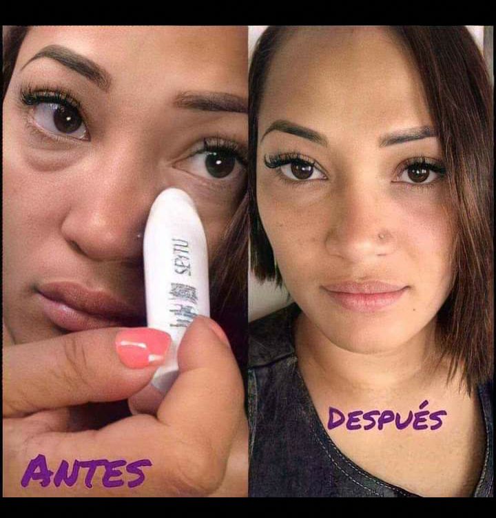 Roller Anti-Ojeras-Unisex